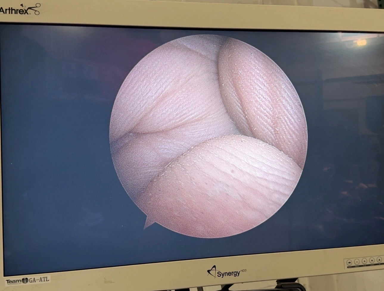 Arthrex Synergy HD3 Arthroscopy Tower System – Complete Integrated Surgical Video & Power Console Package