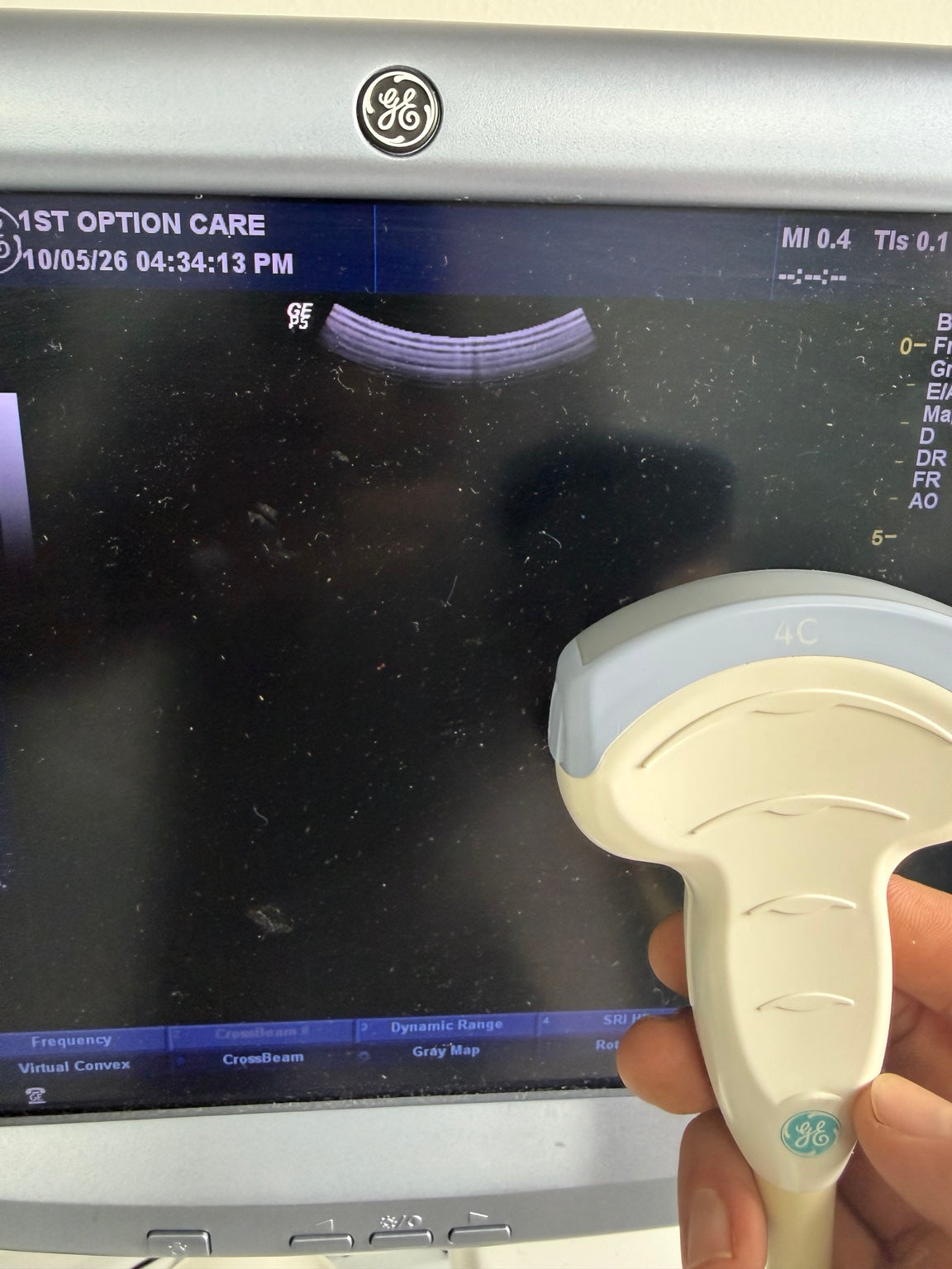 GE LOGIQ P5 ultrasound system 8