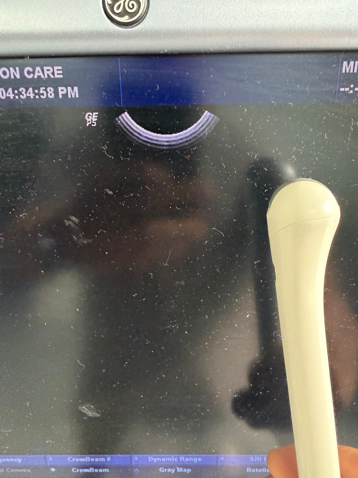 GE LOGIQ P5 ultrasound system 9
